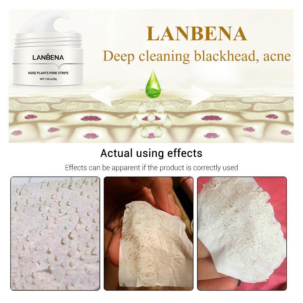 Gleame - Blackhead Tearing Removal Cream
